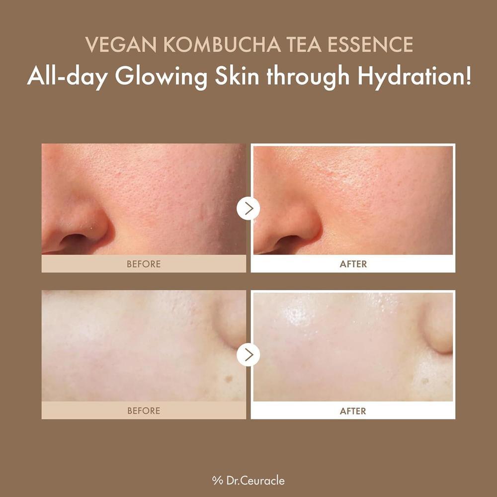 Hydrating Milky Toner Kombucha 150 ml