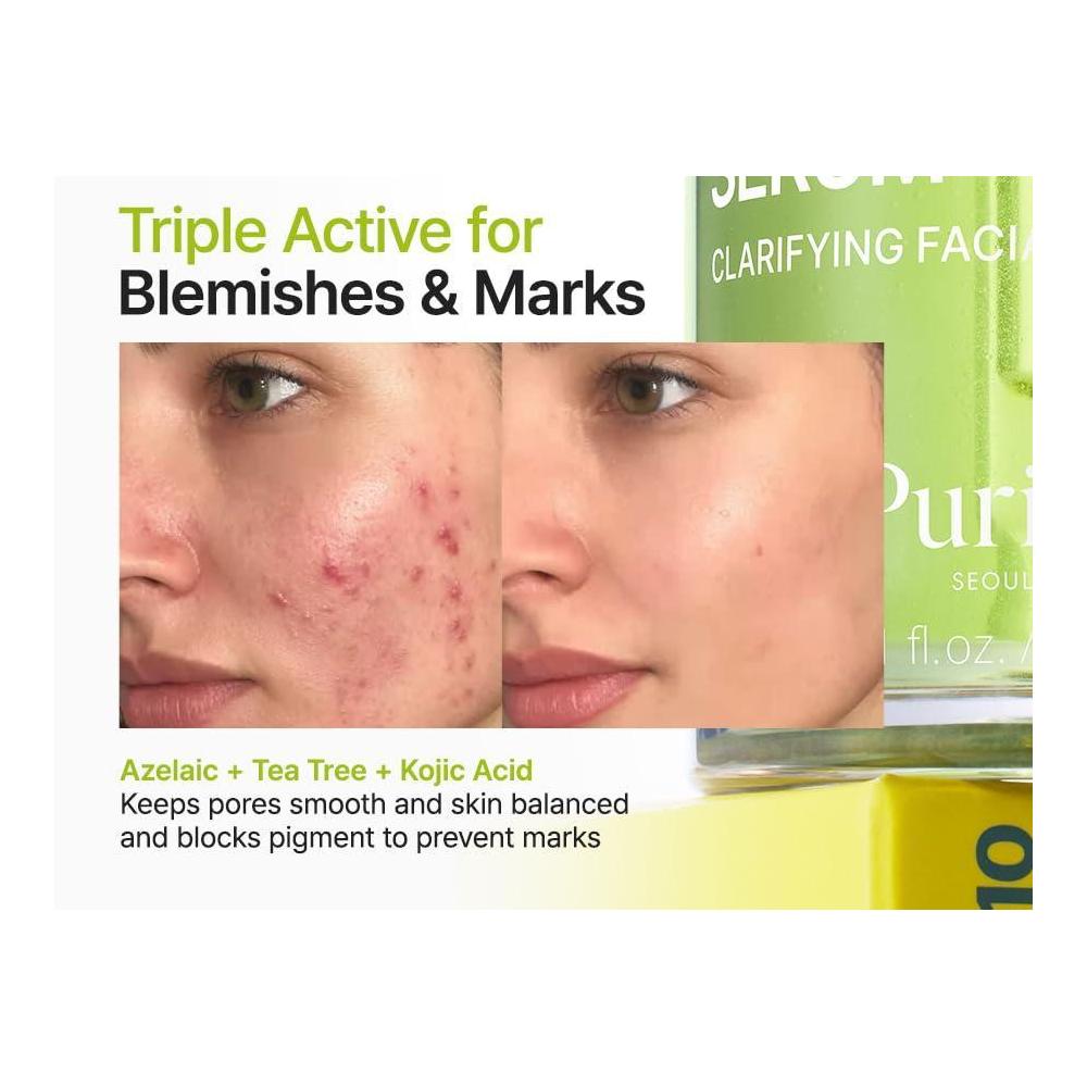 Azelaic Acid 10% Facial Serum 30 ml