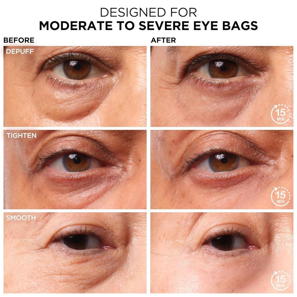 Bye Bye Under Eye Bags Daytime Treatment 0.5 Oz
