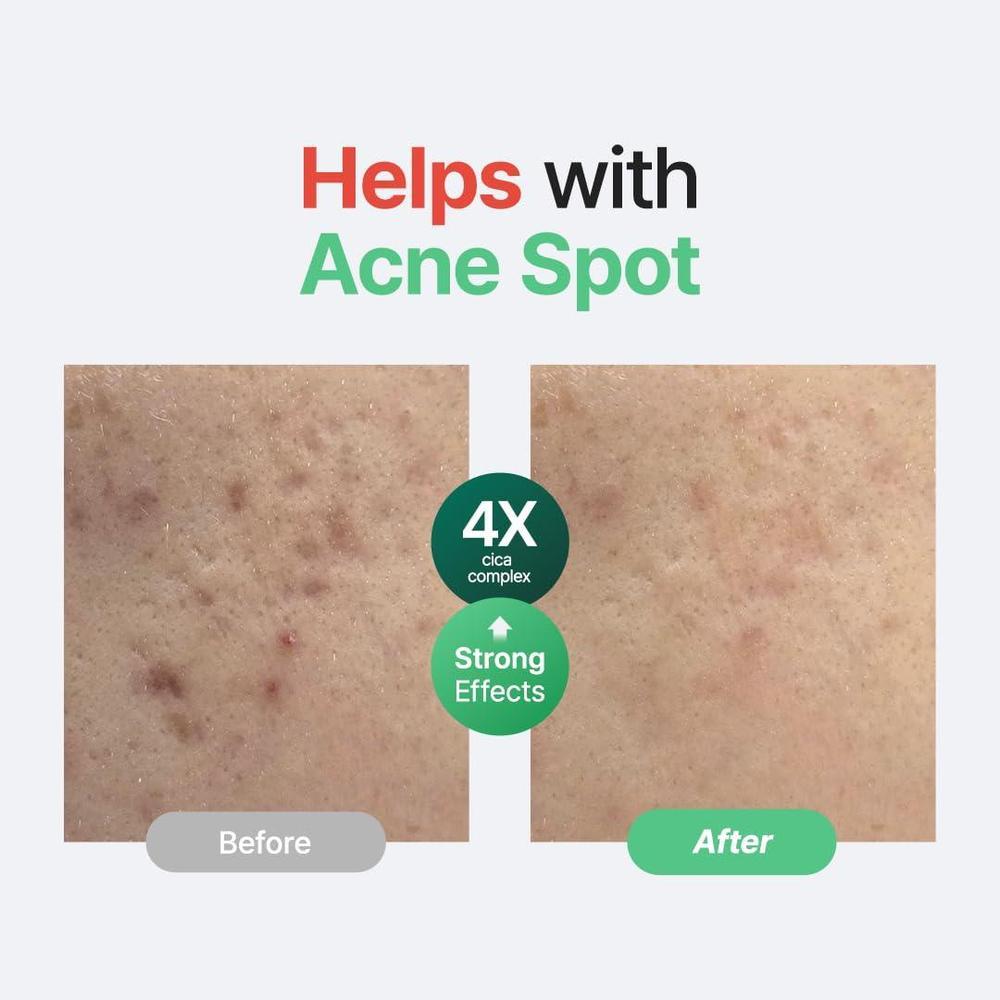 Centella Unscented Serum Soothing Serum 60ml