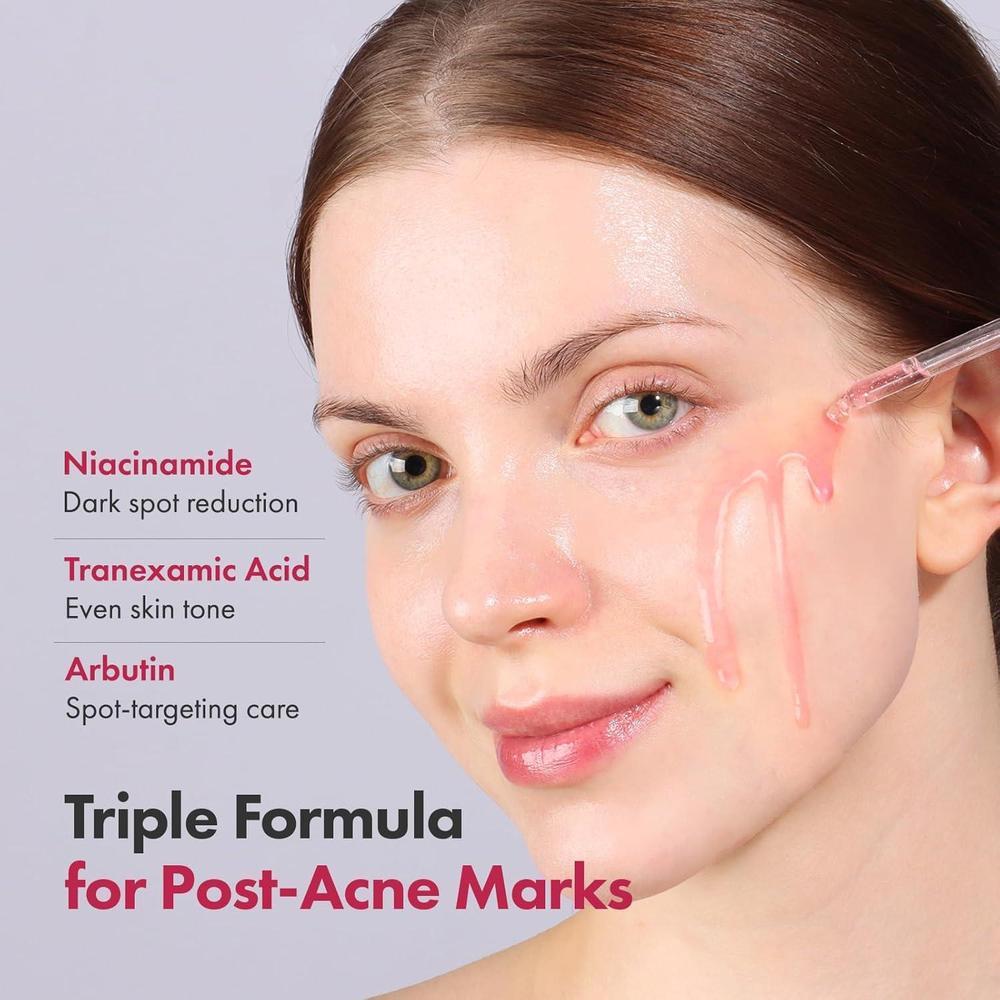 Niacinamide 10% + Tranexamic Acid 4% Serum 33ml