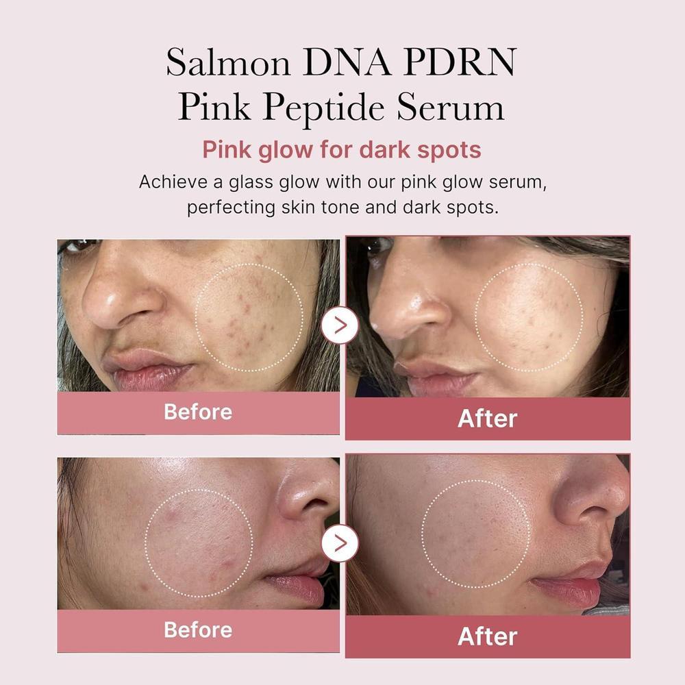 Salmon DNA PDRN Pink Peptide Serum, 30ml