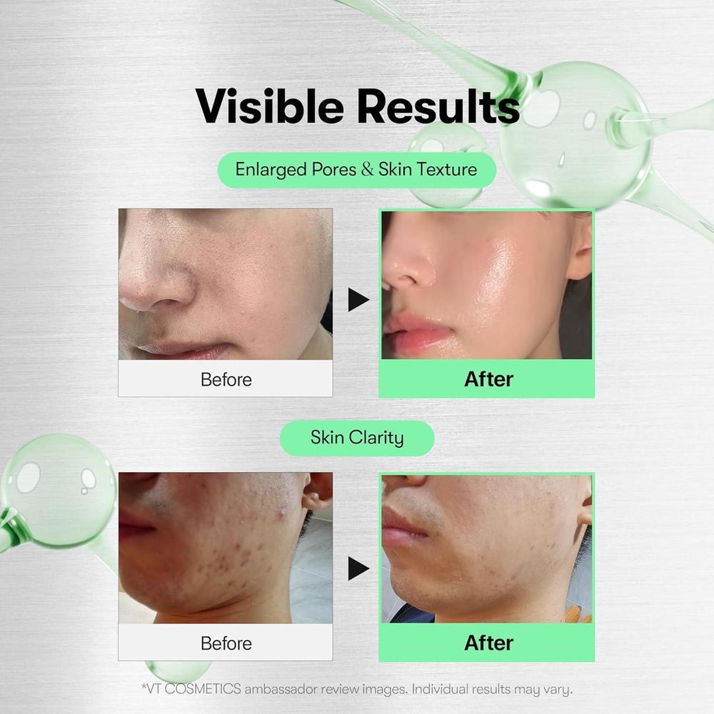 CICA Reedle Shot 100 Spicule Microneedling Serum Exosome Centella Asiatica 50ml