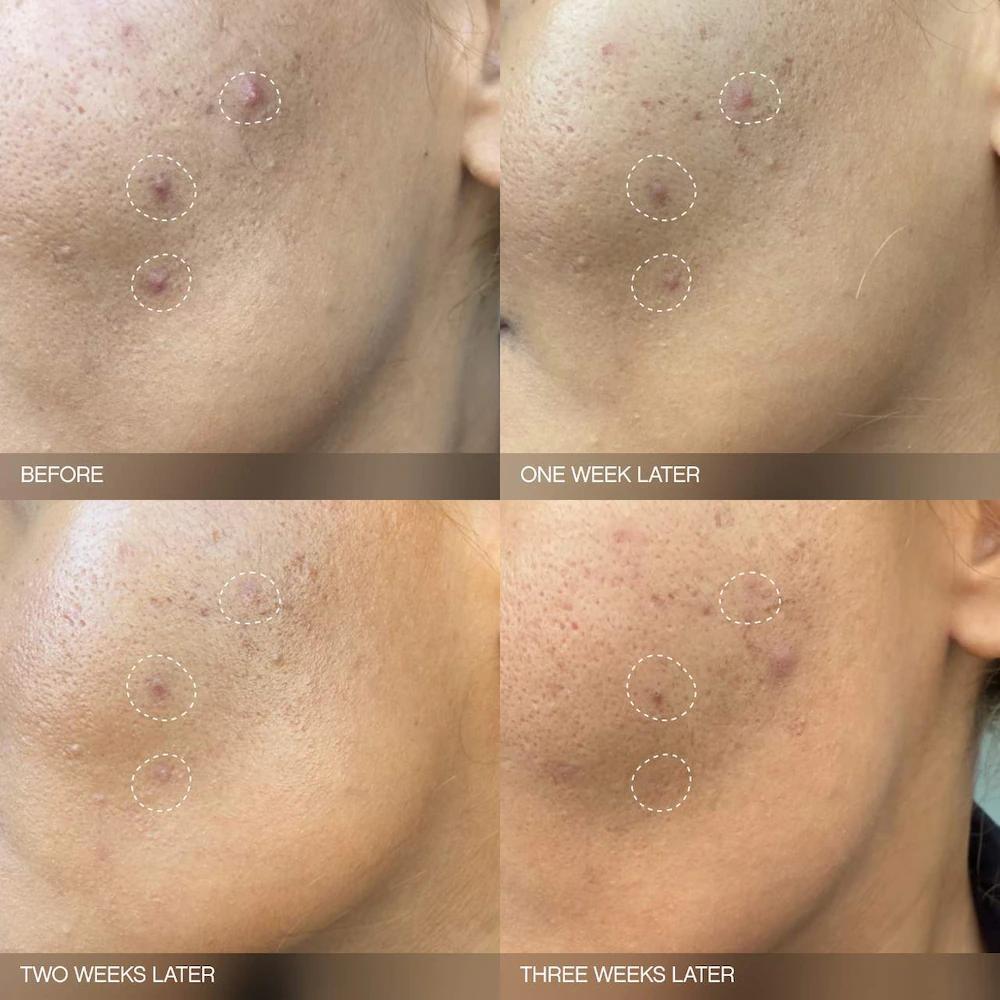 Faded Brightening Bundle for Discoloration on Face & Body (UNSCENTED)