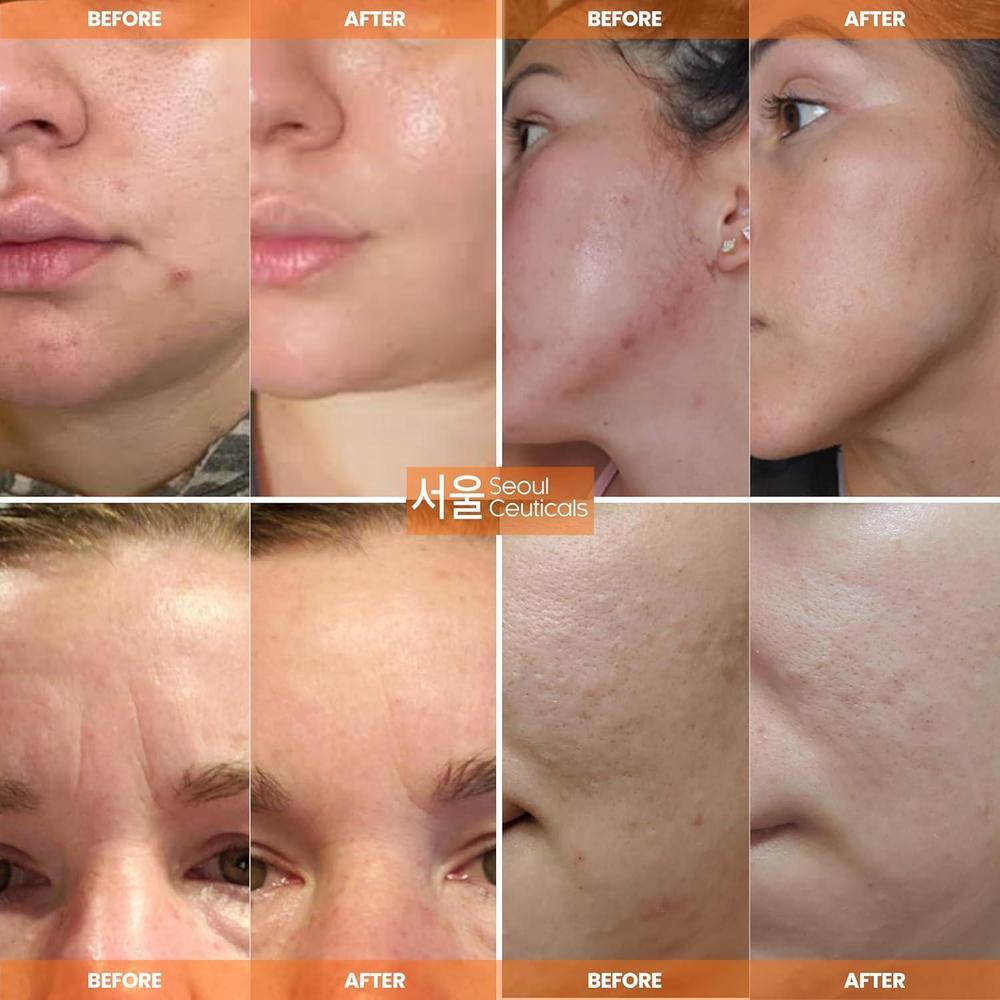 Snail Mucin 97.5% Moisturizer Cream 60ml