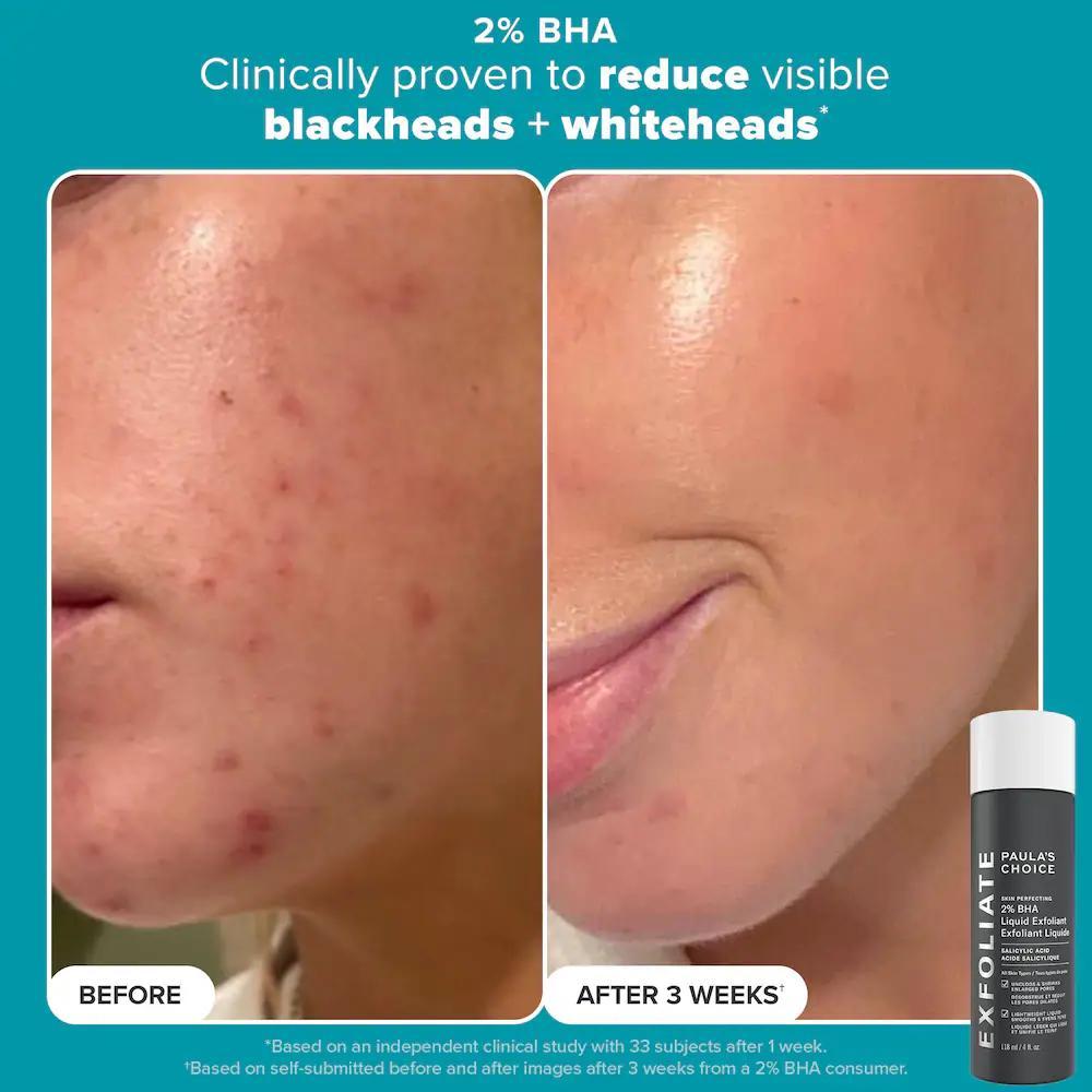 Smooth & Glow Gift Set for clearer, brighter skin