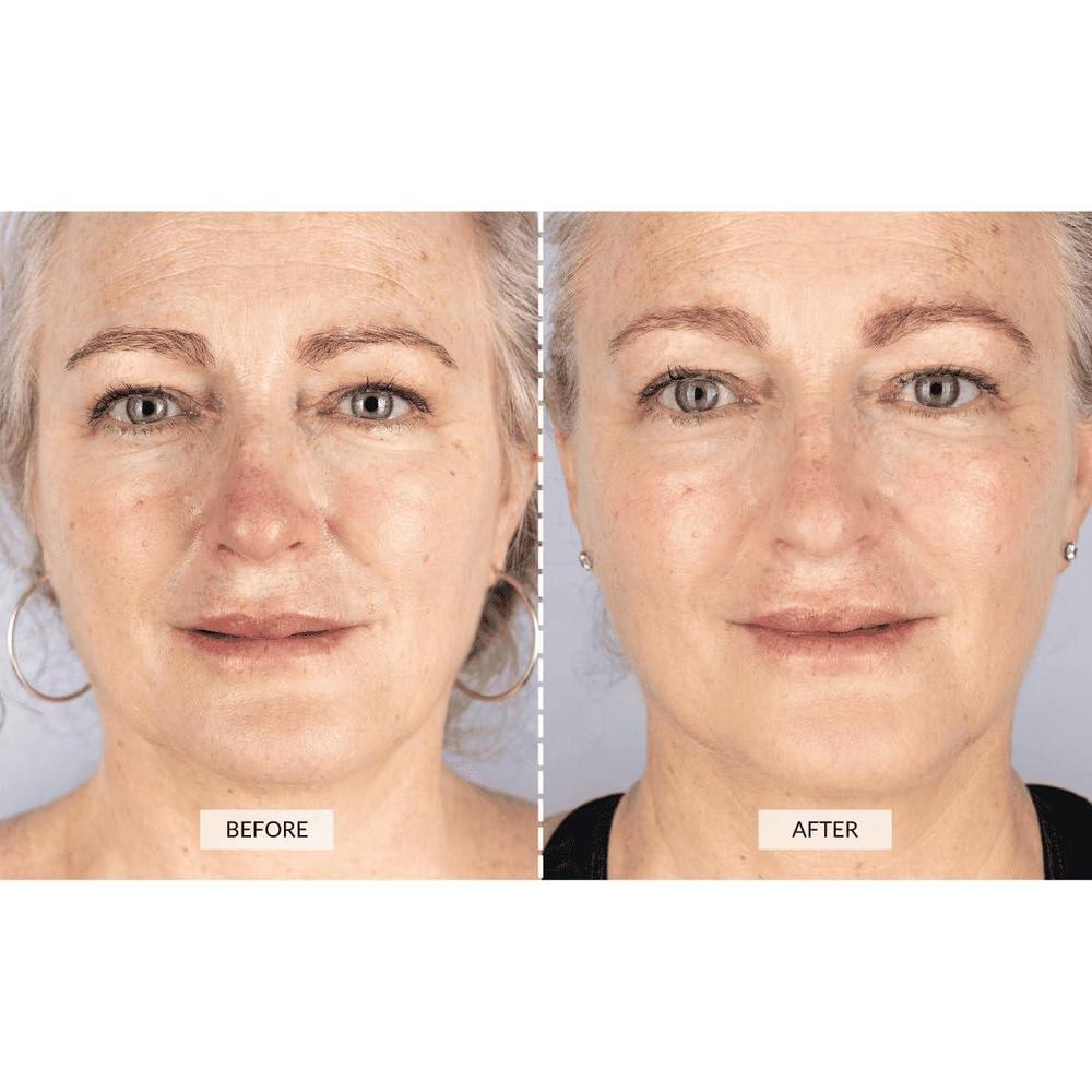 Mask Led Light Therapy Anti-Aging