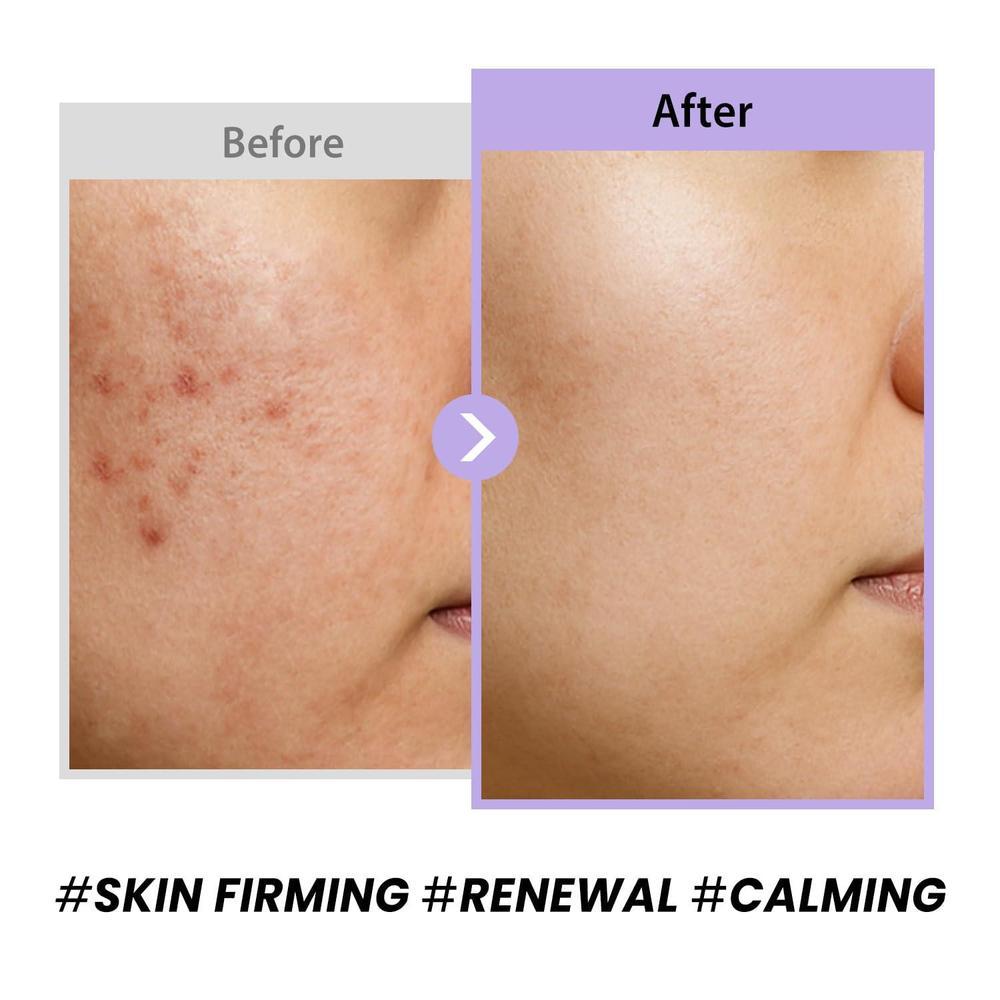 Black Snail Collagen Cream All In One 50ml