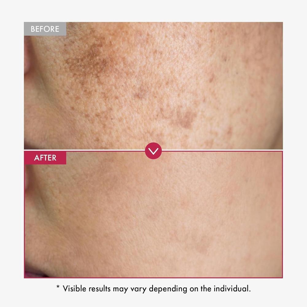 Niacinamide 10% + Tranexamic Acid 4% Serum 33ml