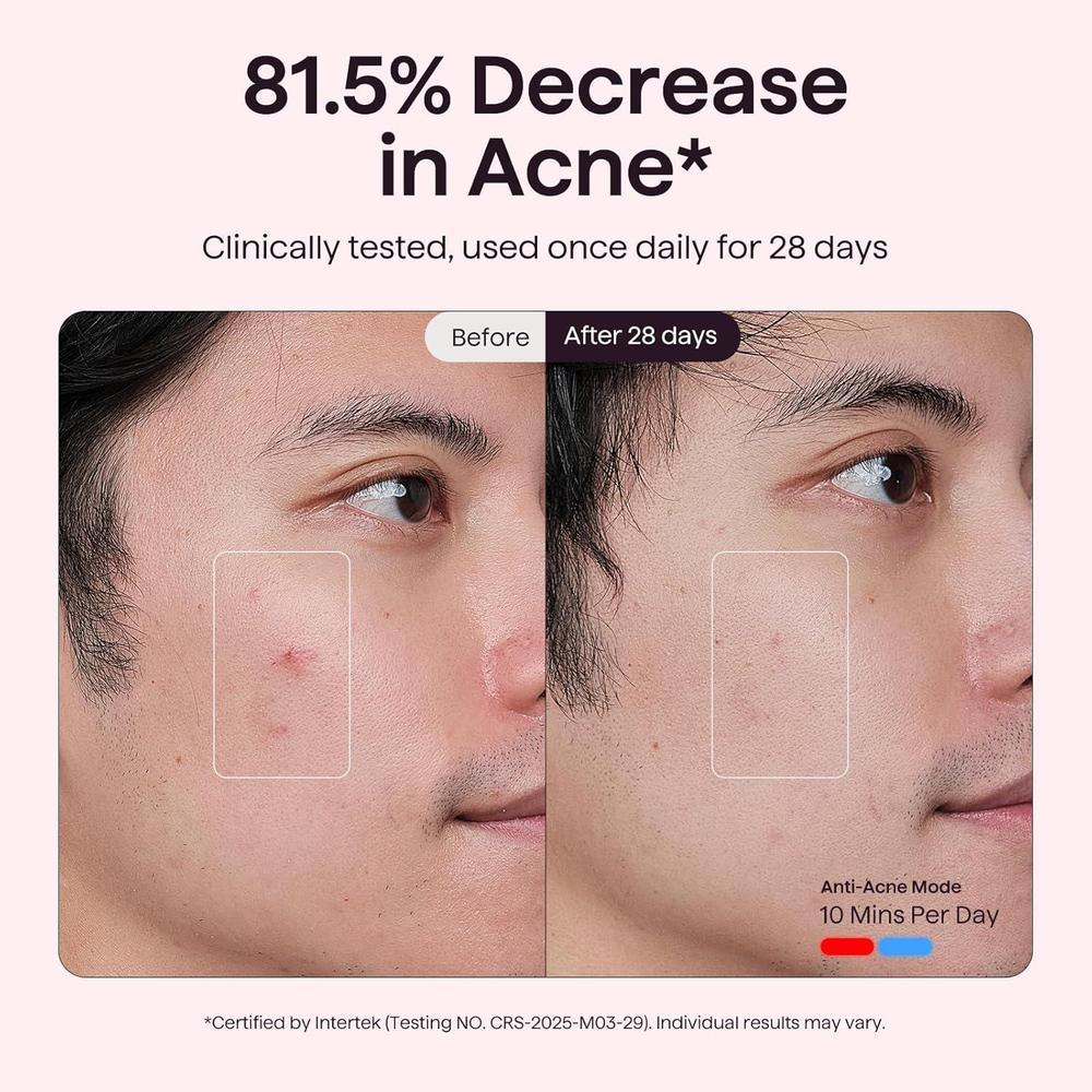 Red Light Therapy Mask for Face
