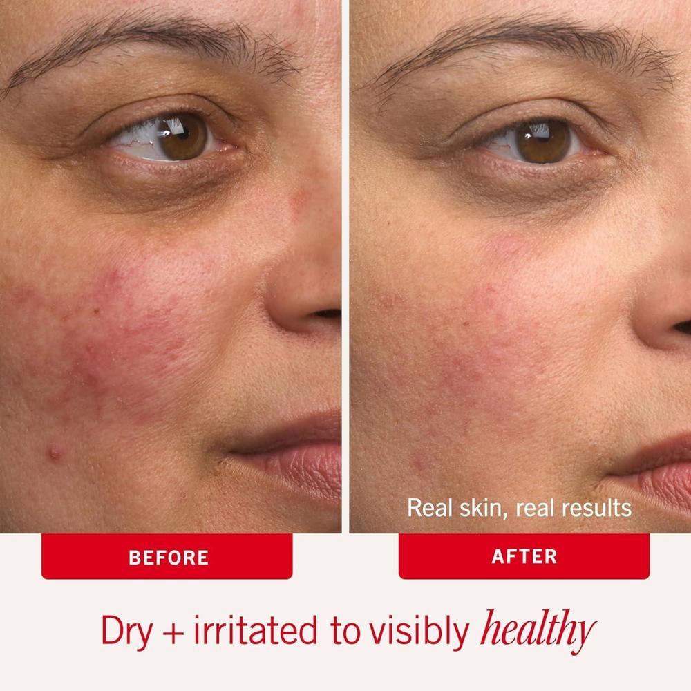 First Aid Beauty Ultra Repair Cream 177ml