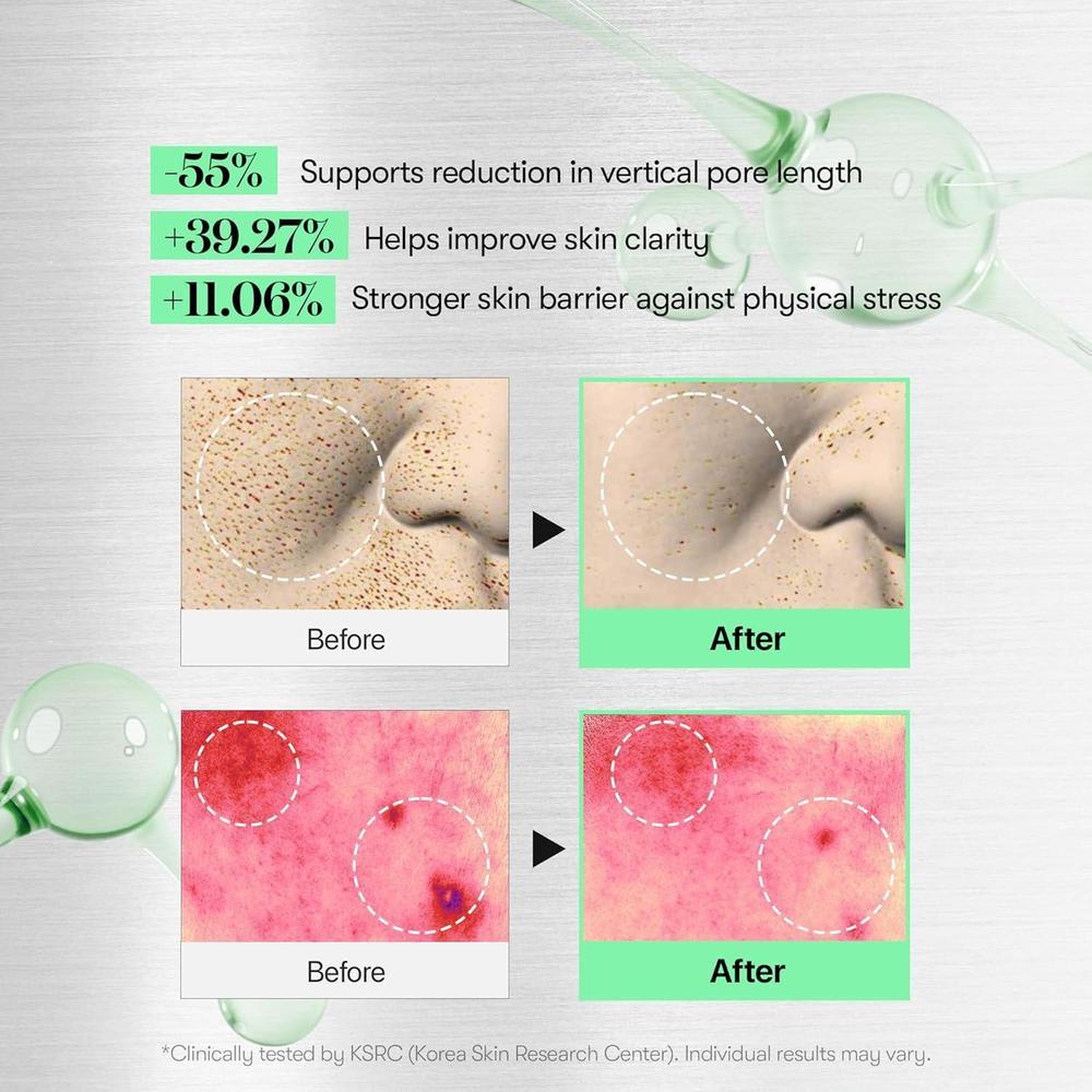 CICA Reedle Shot 100 Spicule Microneedling Serum Exosome Centella Asiatica 50ml