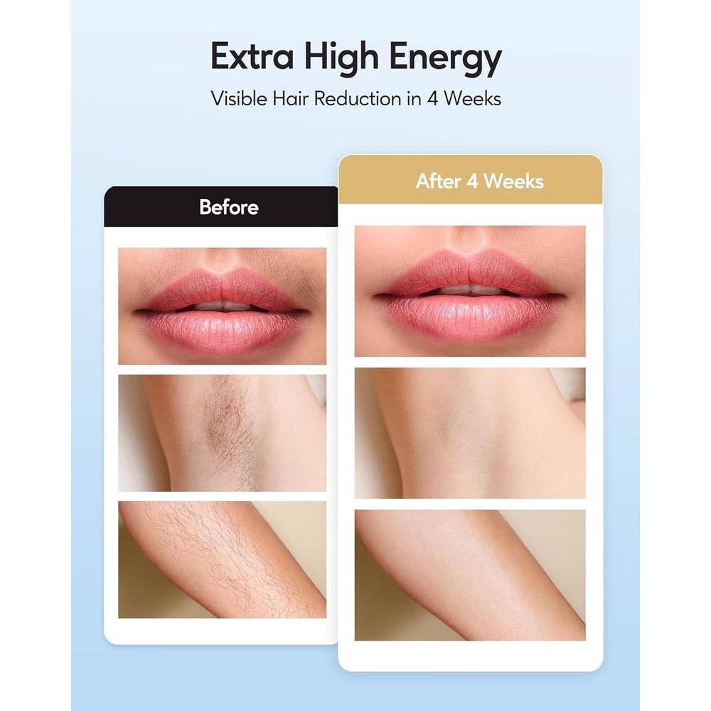 INNZA IPL Hair Removal with Ice Cooling Care Function for Women,Long-Lasting Results,999,999 Flashes Painless IPL Hair Remover, Hair Removal Device for Armpits Legs Arms Bikini Line