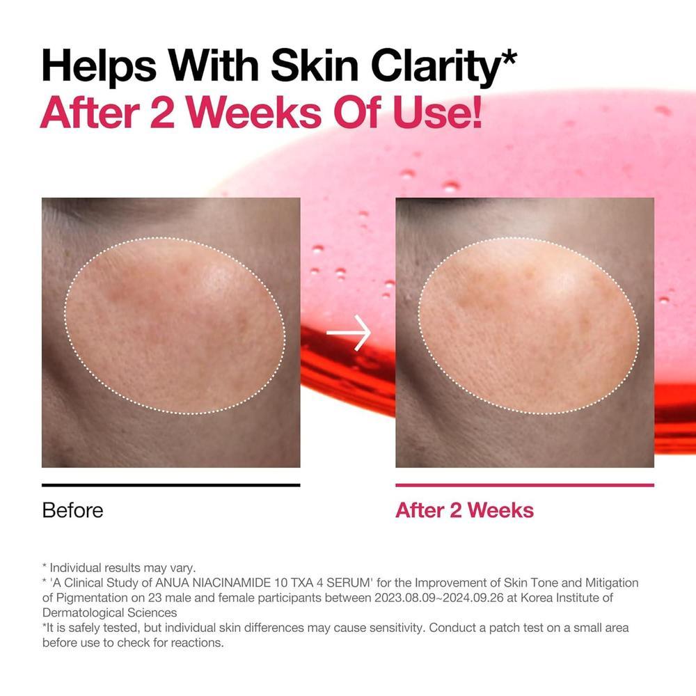 Niacinamide 10% + TXA 4% Serum, Hyaluronic Acid, 30ml