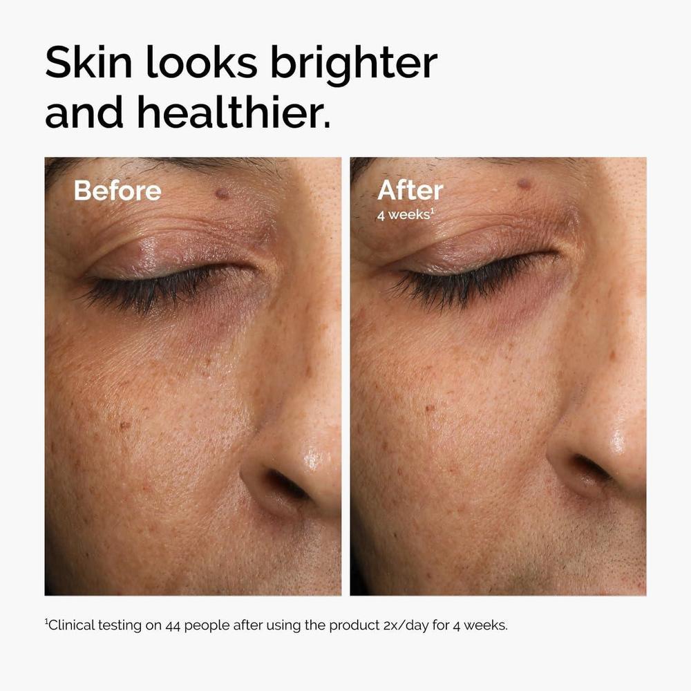 Radiance Serum Vitamin C 29.57ml