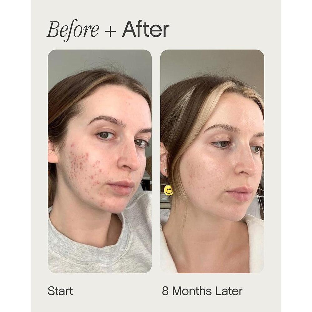 Faded Brightening And Clearing Serum + Kojic Acid Niacinamide 14.8ml