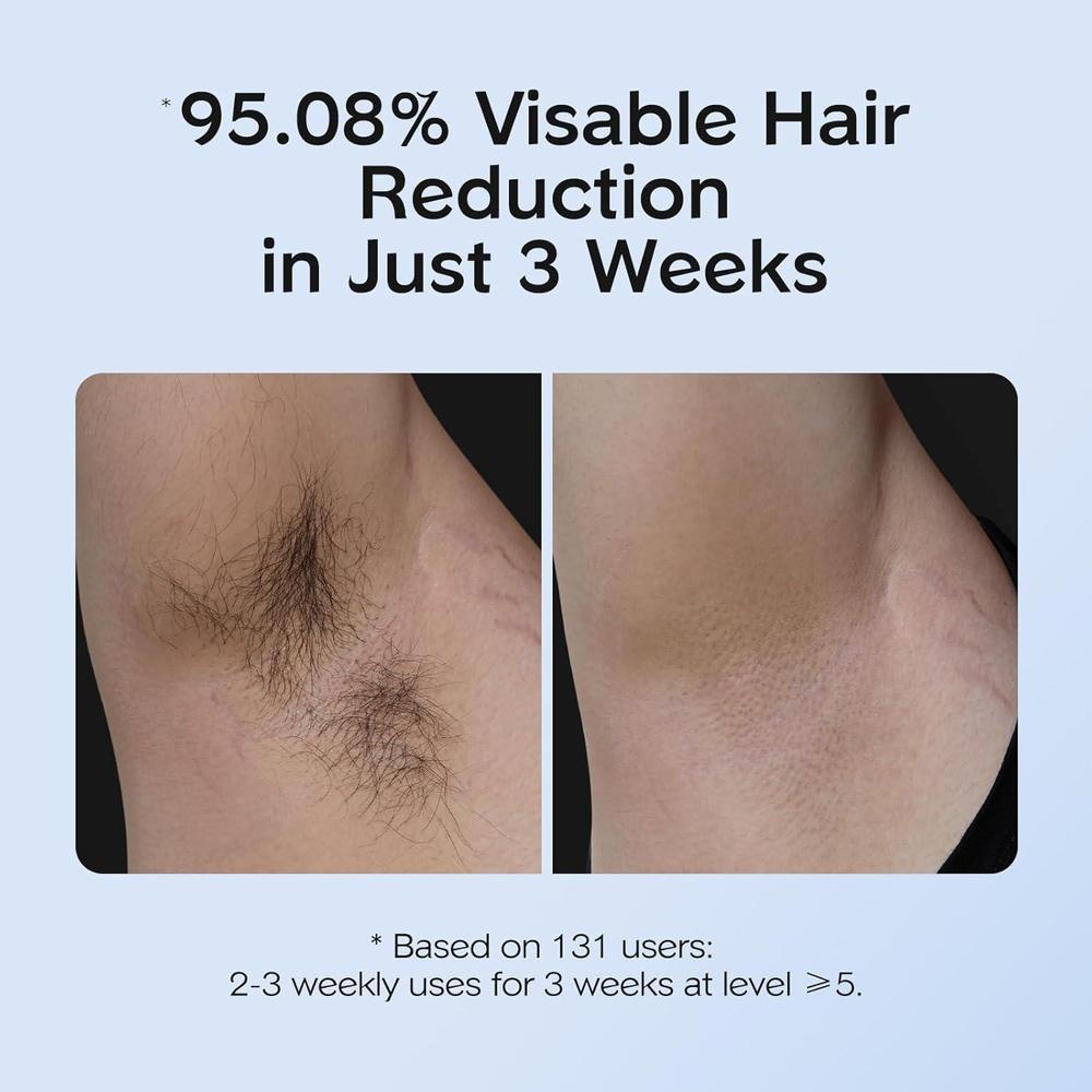Depiladora IPL Hair Removal With Cooling Function