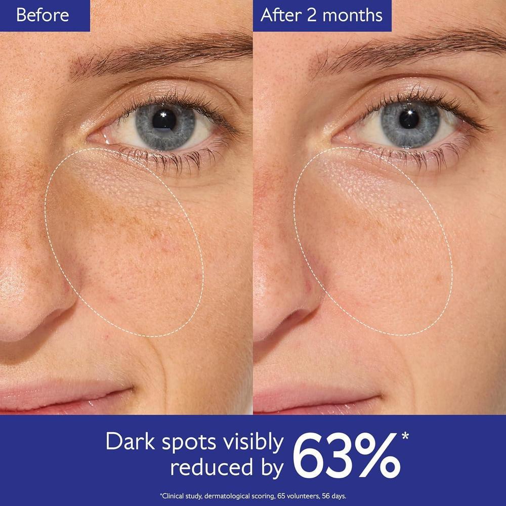 Vinoperfect Brightening Serum 62x More Effective Than Vitamin C