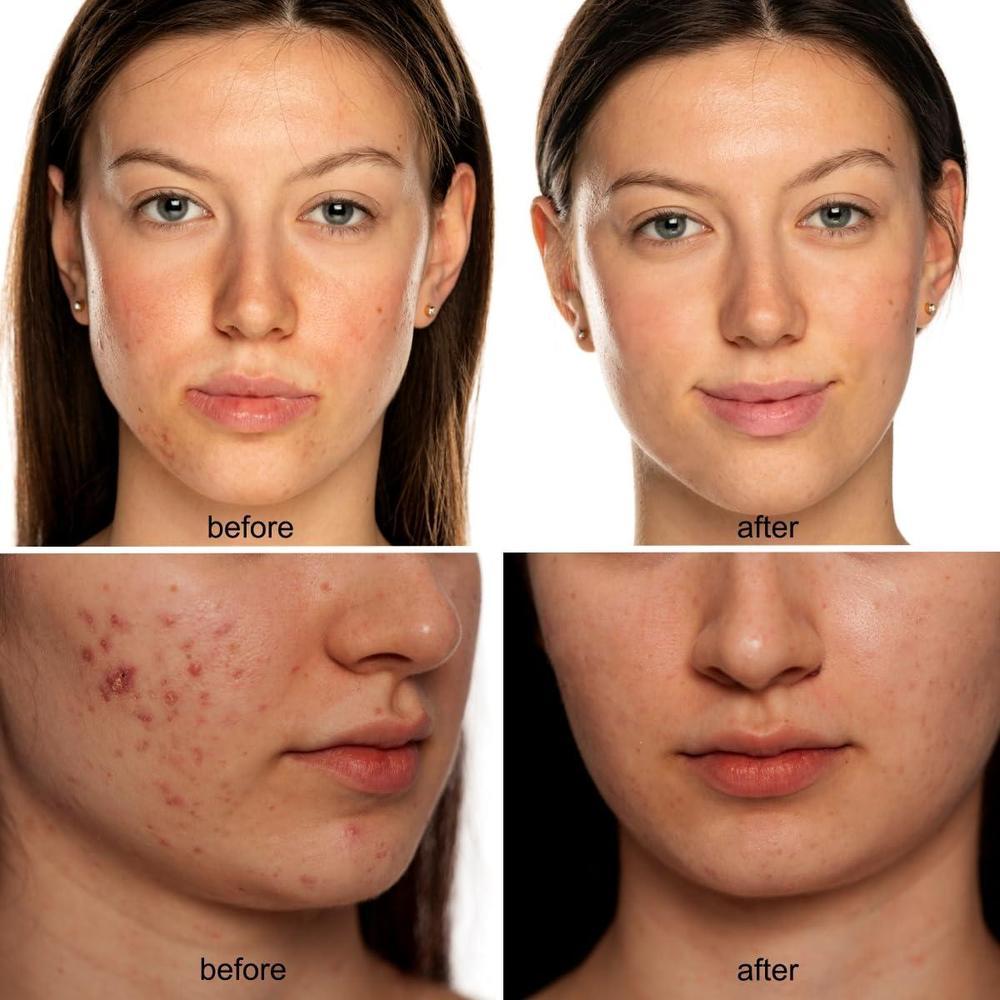 Máscara Led Con Terapia Red Light Para Skincare