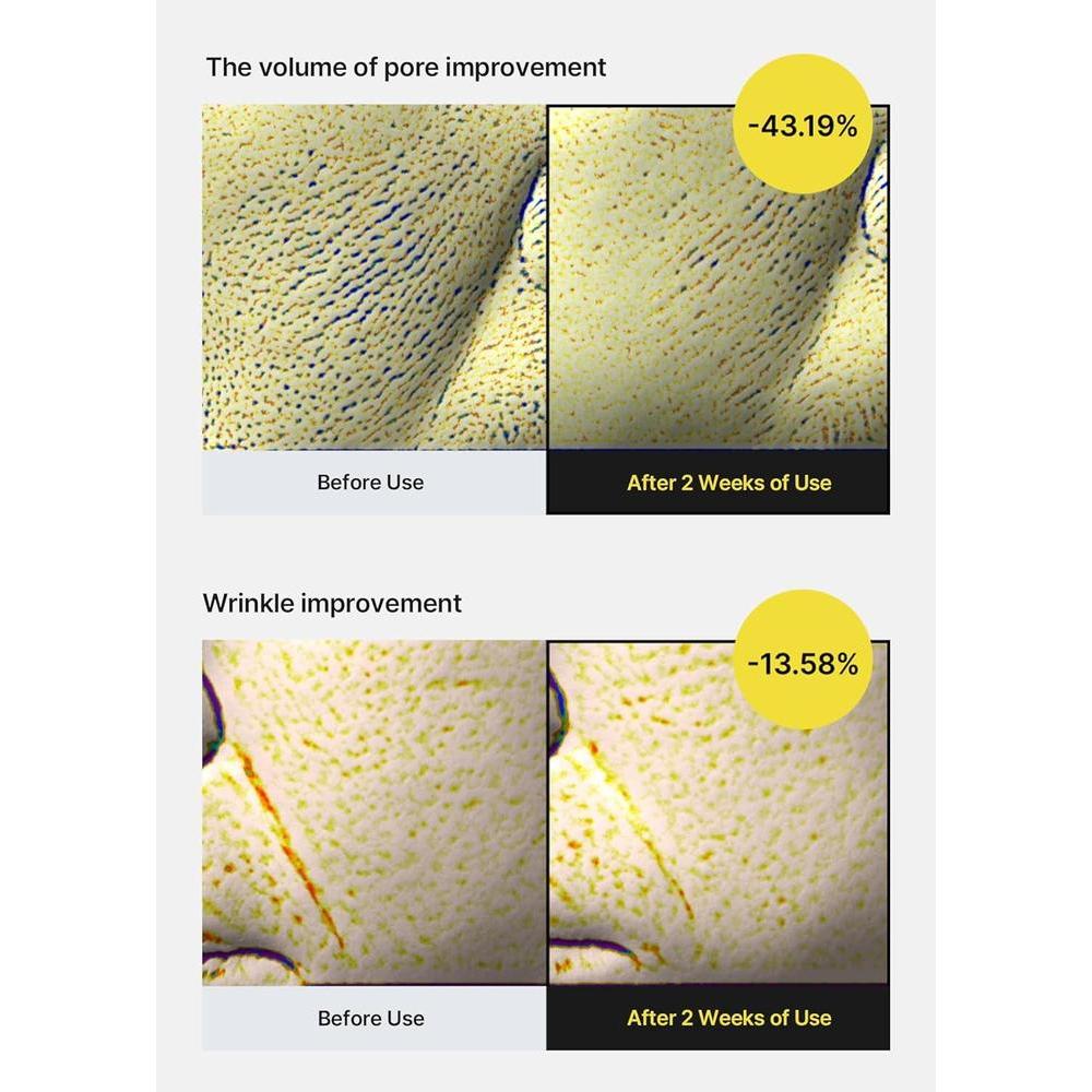 Retinol Shot Tightening Serum 30ml