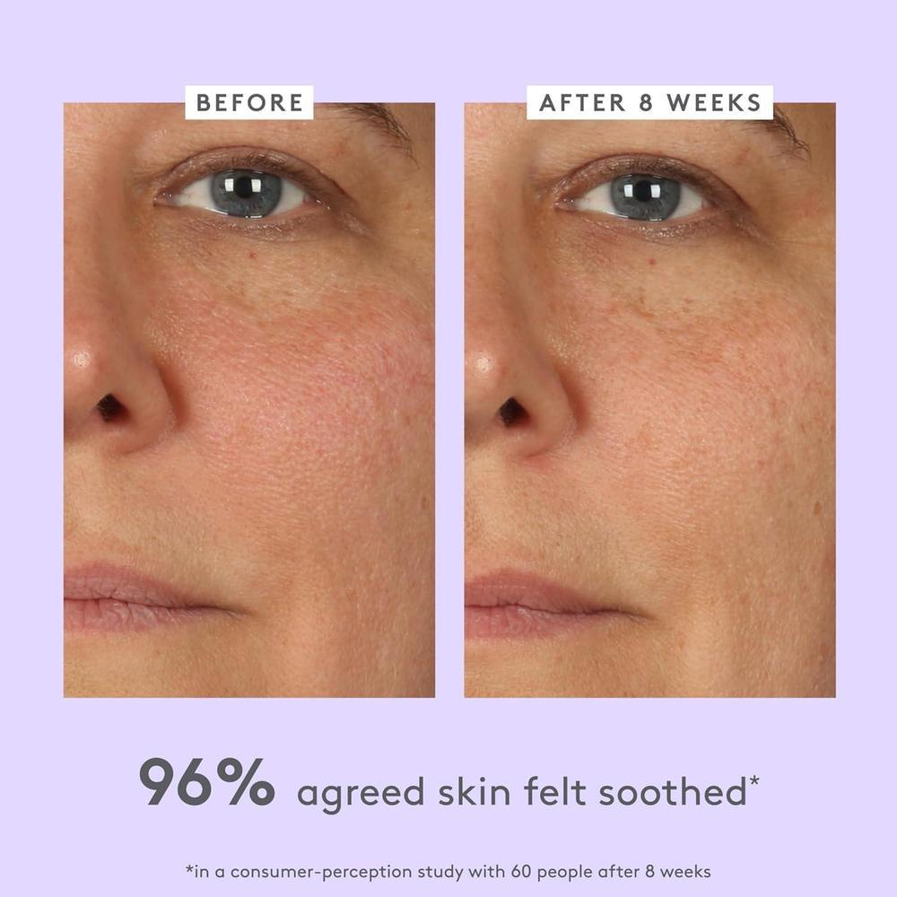 Whipped Cream Ceramide Moisturizer