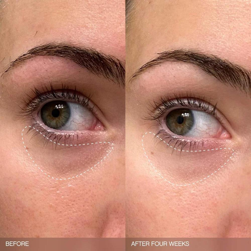 Faded Brightening Bundle for Discoloration on Face & Body (UNSCENTED)