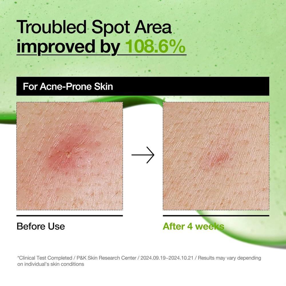 Azelaic Acid 10 Serum For Sensitive Skin 30ml