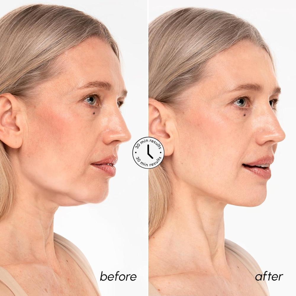V Line Lifting Mask With Retinol & Hyaluronic Acid