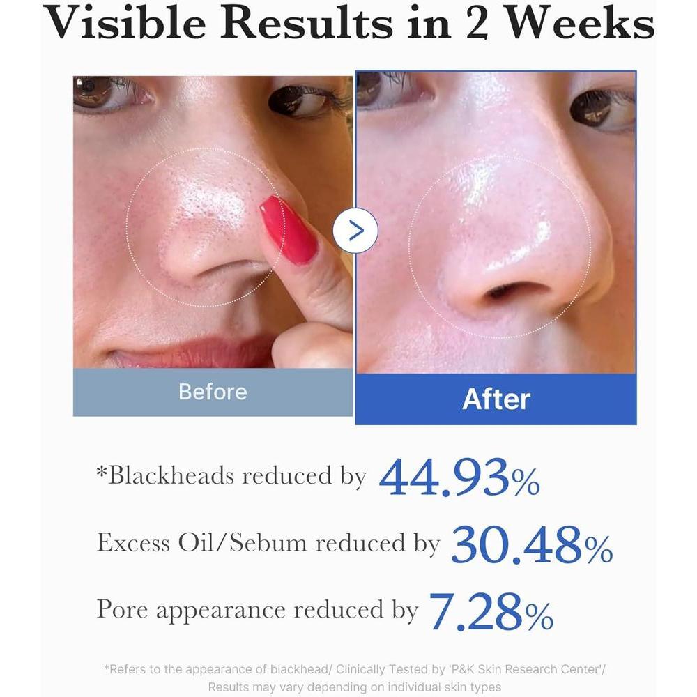 Zero Pore Pads 4.5% AHA 0.45% BHA Exfoliating Toner