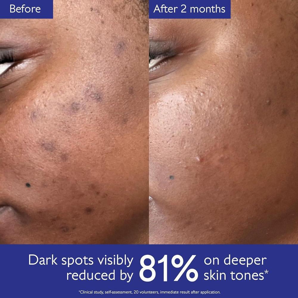 Vinoperfect Brightening Serum 62x More Effective Than Vitamin C