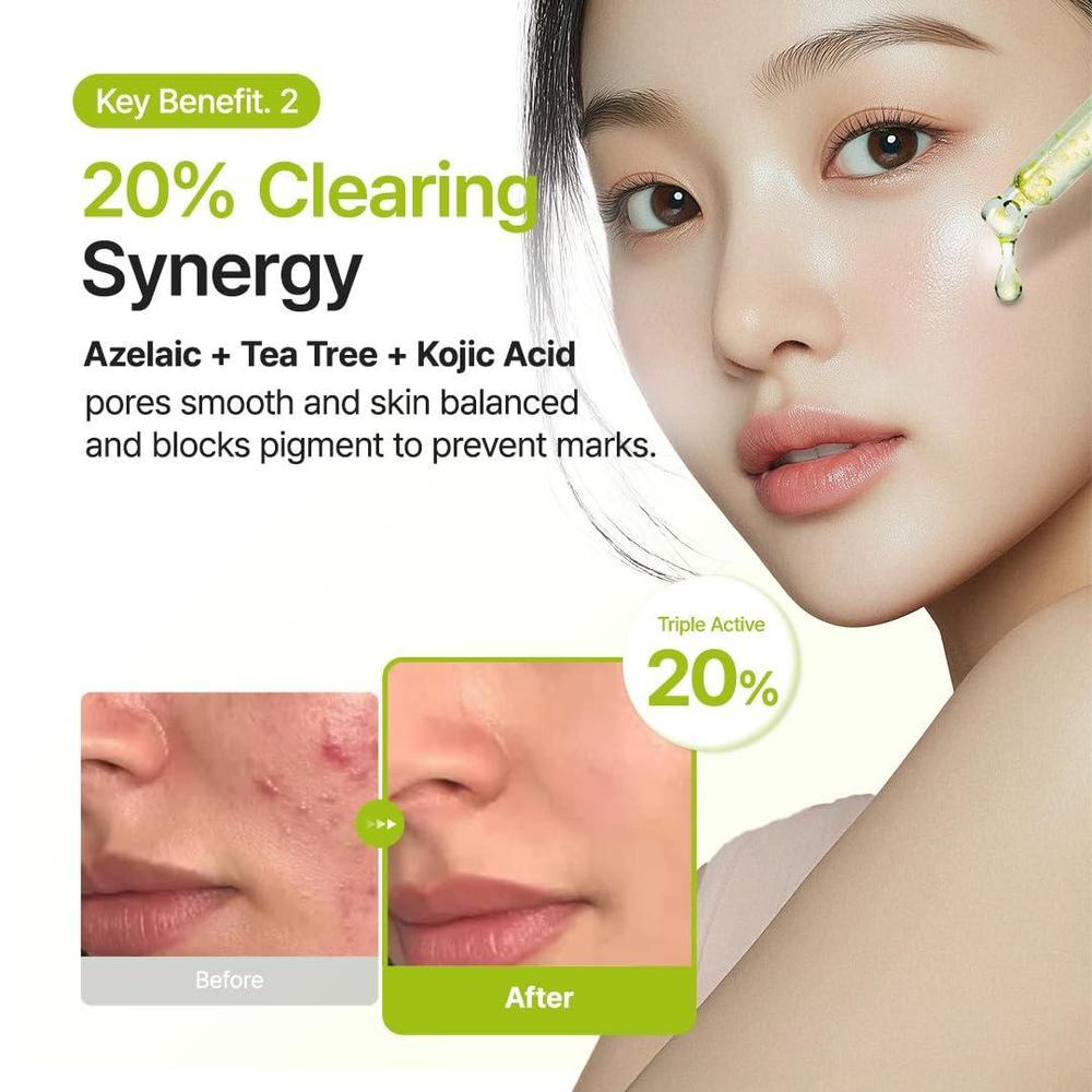 Azelaic Acid 10% Facial Serum 30 ml