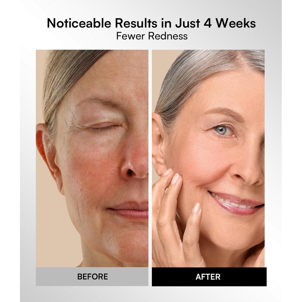 Red Light Therapy Mask - 4 Light Modes NIR Rejuvenation