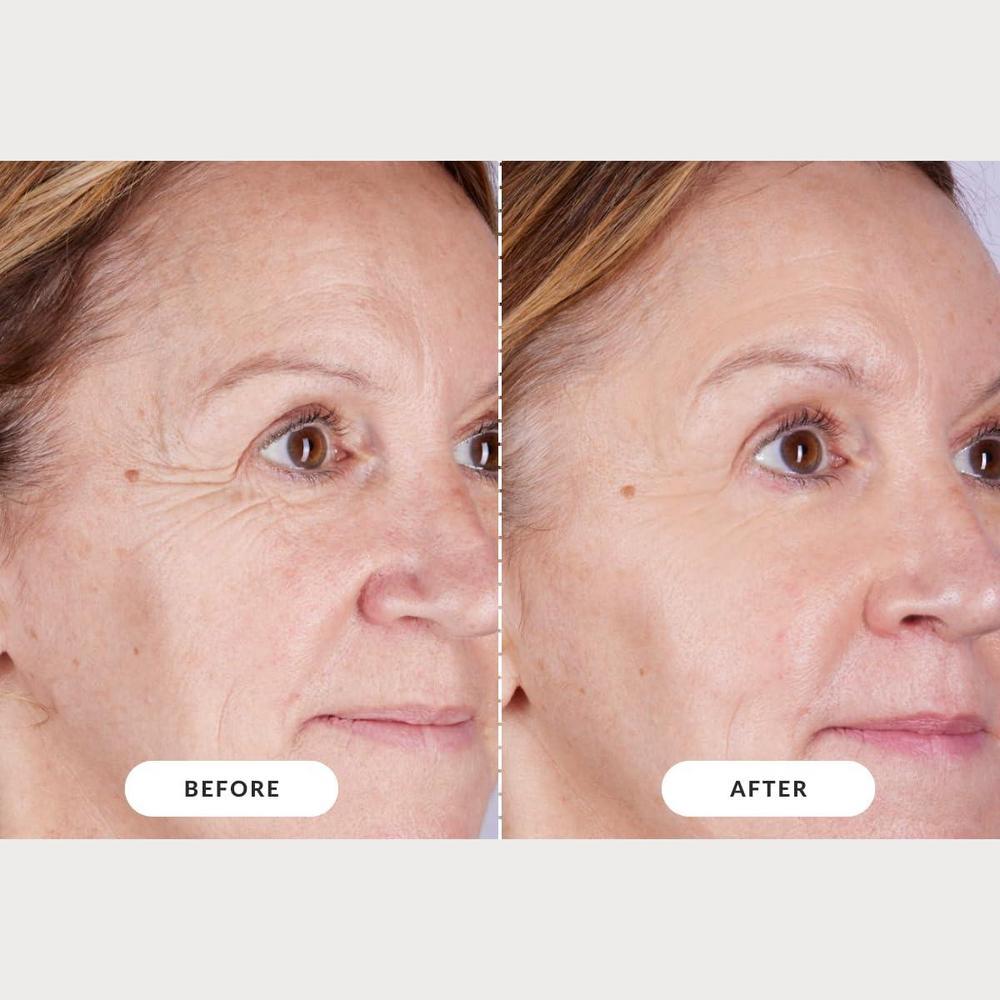 CurrentBody Skin LED Light Therapy Mask: Series 2 – Aztra