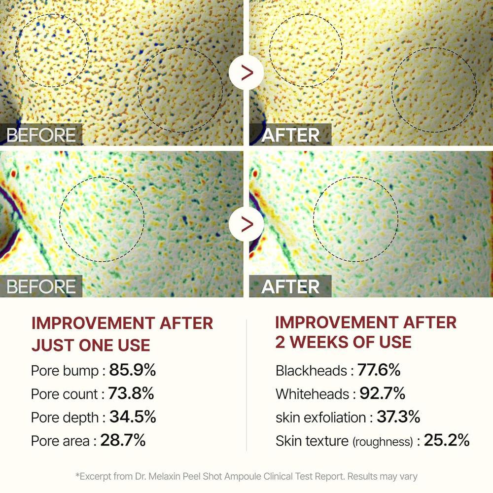 Ampoule Peeling 80ml