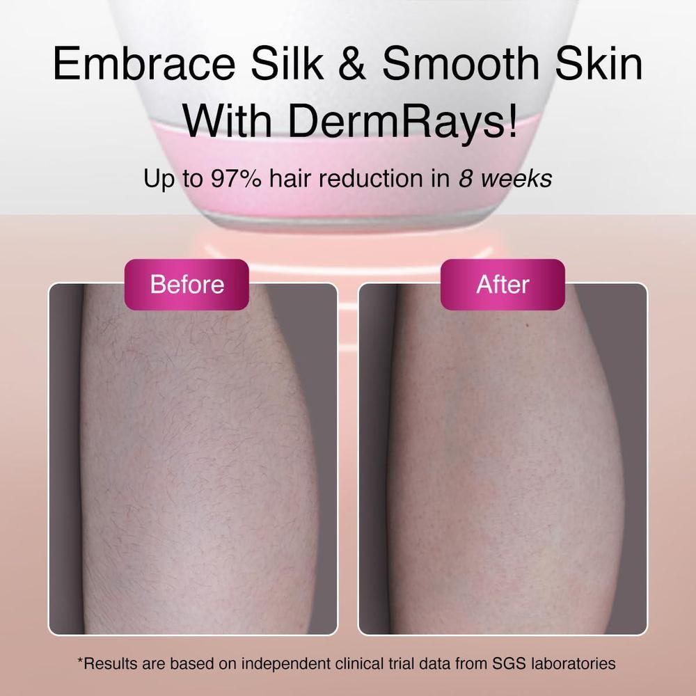 Depiladora láser de diodo DermRays para pieles oscuras con tecnología 1064nm, reducción de cabello permanente. Ideal para hombre y mujer